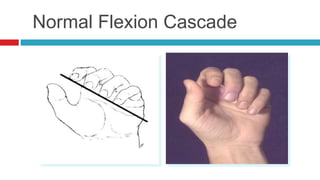Normal Flexion Cascade
 