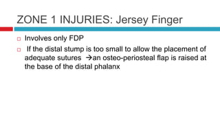 ZONE 1 INJURIES: Jersey Finger
 Involves only FDP
 If the distal stump is too small to allow the placement of
adequate sutures an osteo-periosteal flap is raised at
the base of the distal phalanx
 