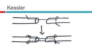 Kessler
 