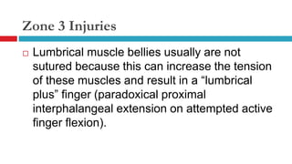 Zone 3 Injuries
 Lumbrical muscle bellies usually are not
sutured because this can increase the tension
of these muscles and result in a “lumbrical
plus” finger (paradoxical proximal
interphalangeal extension on attempted active
finger flexion).
 