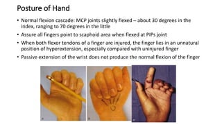 Posture of Hand
• Normal flexion cascade: MCP joints slightly flexed – about 30 degrees in the
index, ranging to 70 degrees in the little
• Assure all fingers point to scaphoid area when flexed at PIPs joint
• When both flexor tendons of a finger are injured, the finger lies in an unnatural
position of hyperextension, especially compared with uninjured finger
• Passive extension of the wrist does not produce the normal flexion of the finger
 