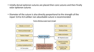 • Initally dorsal epitenon sutures are placed then core sutures and then finally
volar epitenon sutures
• Diameter of the suture is also directly porportional to the strength of the
repair 3.0 to 4.0 calliber non absorbable suture is recommended
 