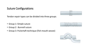 Suture Configurations
Tendon repair types can be divided into three groups
• Group 1: Simple suture
• Group 2 : Bunnell suture
• Group 3: Pulvertaft technique (fish-mouth weave)
 