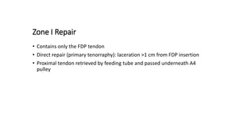 Zone I Repair
• Contains only the FDP tendon
• Direct repair (primary tenorraphy): laceration >1 cm from FDP insertion
• Proximal tendon retrieved by feeding tube and passed underneath A4
pulley
 
