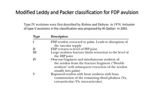 Modified Leddy and Packer classification for FDP avulsion
Type IV avulsions were first described by Robins and Dobyns in 1974. Inclusion
of type V avulsions in the classification was proposed by Al-Qattan in 2001
 