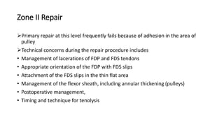 Zone II Repair
Primary repair at this level frequently fails because of adhesion in the area of
pulley
Technical concerns during the repair procedure includes
• Management of lacerations of FDP and FDS tendons
• Appropriate orientation of the FDP with FDS slips
• Attachment of the FDS slips in the thin flat area
• Management of the flexor sheath, including annular thickening (pulleys)
• Postoperative management,
• Timing and technique for tenolysis
 