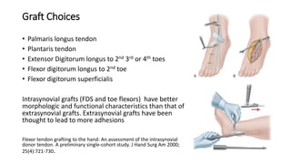 Graft Choices
• Palmaris longus tendon
• Plantaris tendon
• Extensor Digitorum longus to 2nd 3rd or 4th toes
• Flexor digitorum longus to 2nd toe
• Flexor digitorum superficialis
Intrasynovial grafts (FDS and toe flexors) have better
morphologic and functional characteristics than that of
extrasynovial grafts. Extrasynovial grafts have been
thought to lead to more adhesions
Flexor tendon grafting to the hand: An assessment of the intrasynovial
donor tendon. A preliminary single-cohort study. J Hand Surg Am 2000;
25(4):721-730.
 