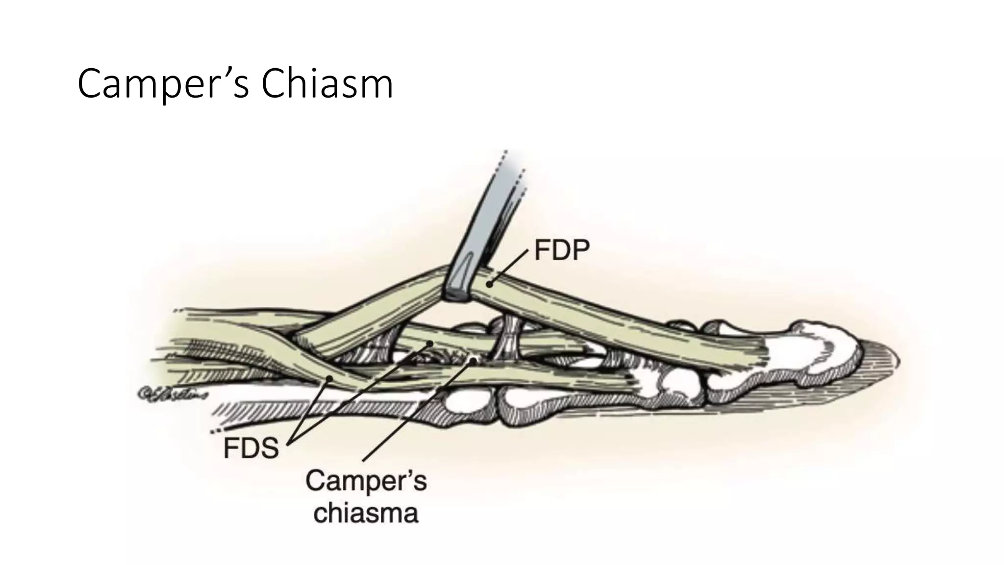 Camper’s Chiasm
 
