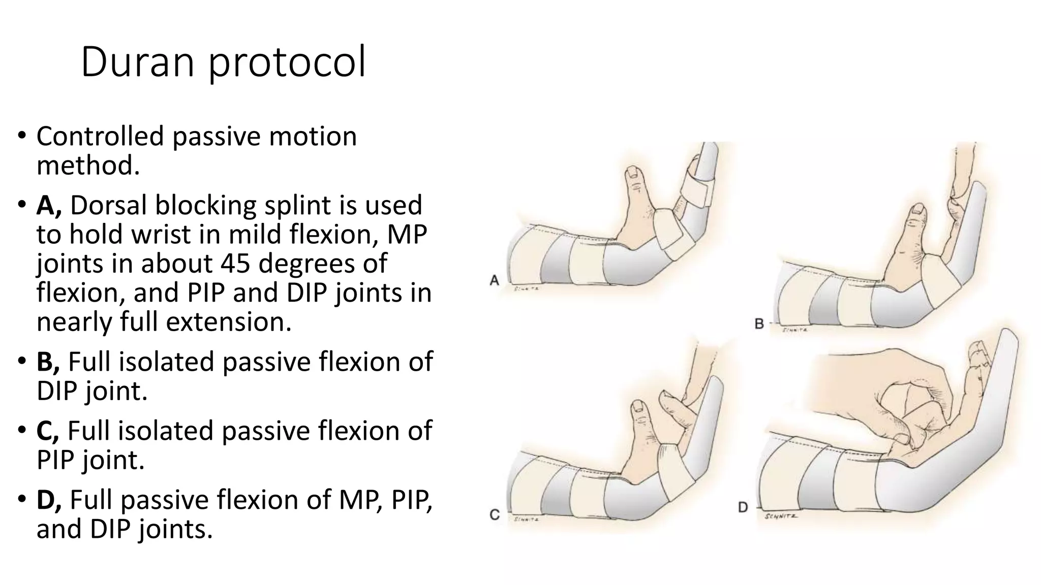 Duran protocol
• Controlled passive motion
method.
• A, Dorsal blocking splint is used
to hold wrist in mild flexion, MP
joints in about 45 degrees of
flexion, and PIP and DIP joints in
nearly full extension.
• B, Full isolated passive flexion of
DIP joint.
• C, Full isolated passive flexion of
PIP joint.
• D, Full passive flexion of MP, PIP,
and DIP joints.
 
