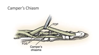 Camper’s Chiasm
 