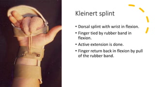 Kleinert splint
• Dorsal splint with wrist in flexion.
• Finger tied by rubber band in
flexion.
• Active extension is done.
• Finger return back in flexion by pull
of the rubber band.
 