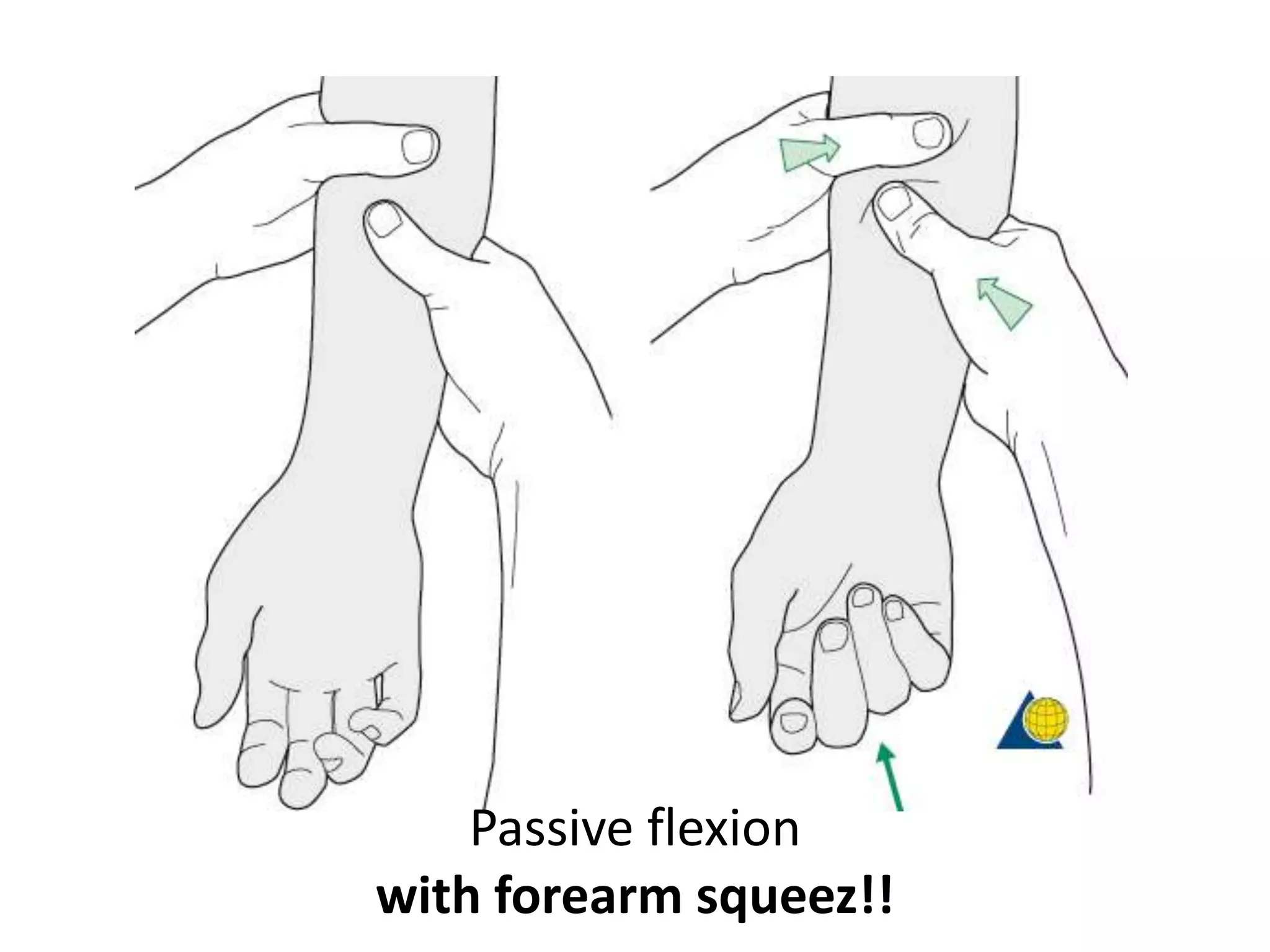 Passive flexion
with forearm squeez!!
 