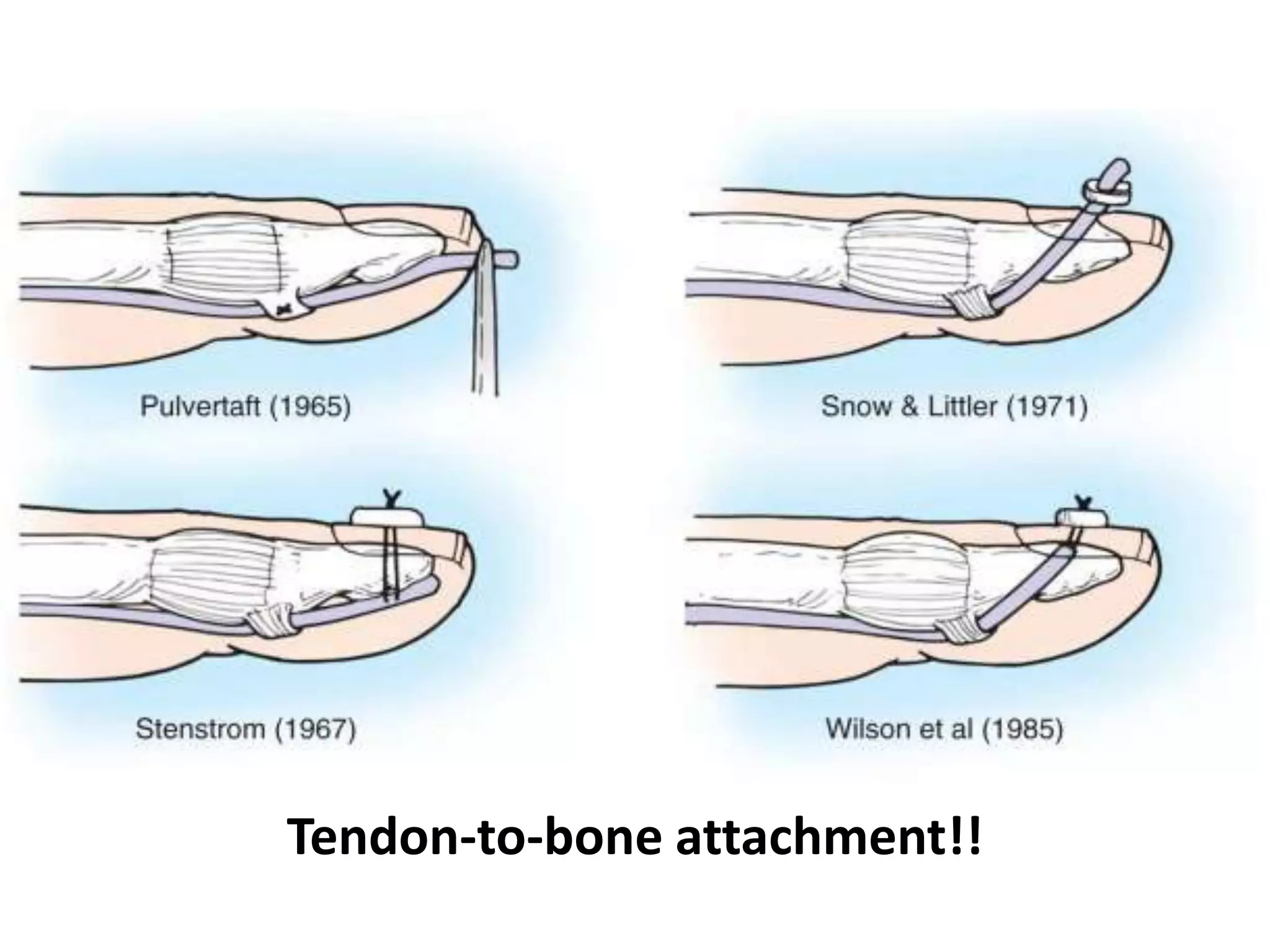 Tendon-to-bone attachment!!
 