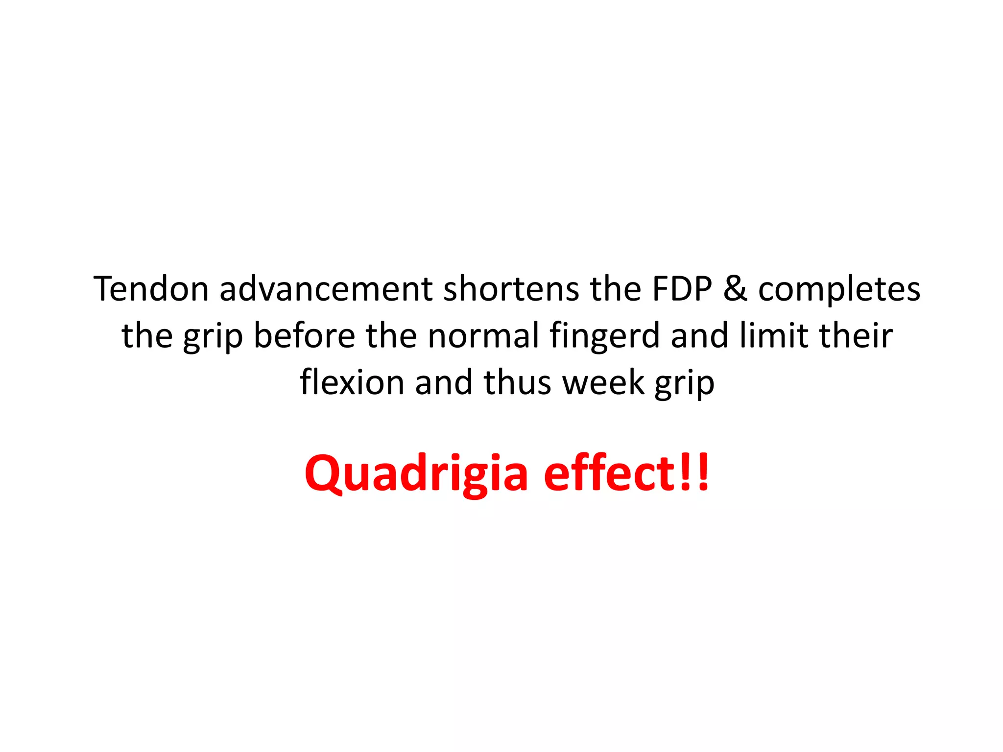 Tendon advancement shortens the FDP & completes
  the grip before the normal fingerd and limit their
              flexion and thus week grip

             Quadrigia effect!!
 