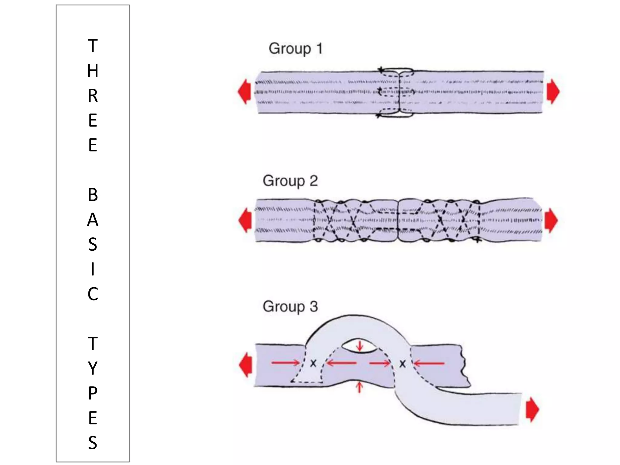 T
H
R
E
E

B
A
S
I
C

T
Y
P
E
S
 