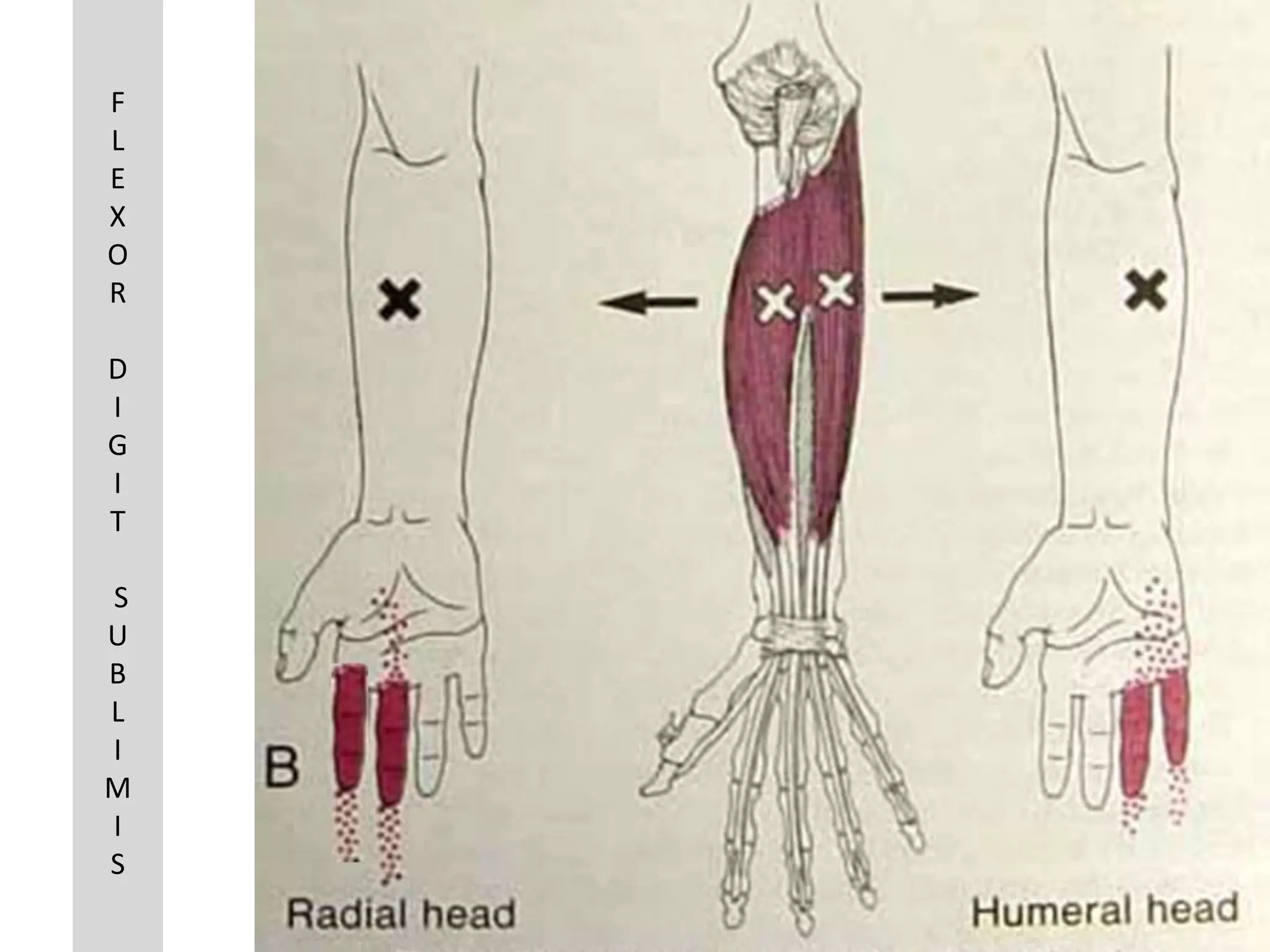 F
L
E
X
O
R

D
I
G
I
T

S
U
B
L
I
M
I
S
 