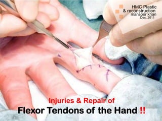 HMC Plastic
                              & reconstruction
                                 mansoor khan
                                      Dec, 2011




       Injuries & Repair of
Flexor Tendons of the Hand !!
 