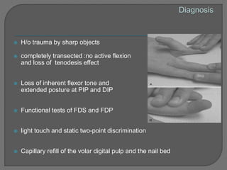 Fds Injuries Flexor tendon injury | PPTX