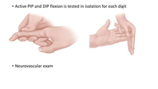 Flexor Tendon Injury.pptx