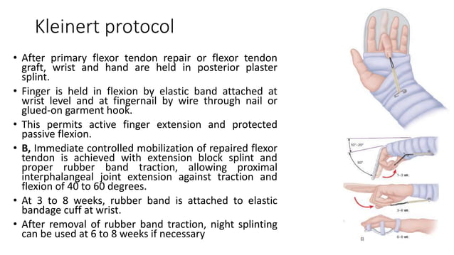 Tendon Testing Hand Flexor Tendon Injury.pptx