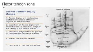 Flexor tendon injury, management and rehabilitation | PPTX
