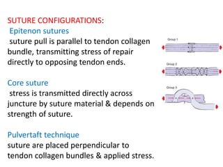 SUTURE CONFIGURATIONS:
Epitenon sutures
suture pull is parallel to tendon collagen
bundle, transmitting stress of repair
directly to opposing tendon ends.
Core suture
stress is transmitted directly across
juncture by suture material & depends on
strength of suture.
Pulvertaft technique
suture are placed perpendicular to
tendon collagen bundles & applied stress.
 