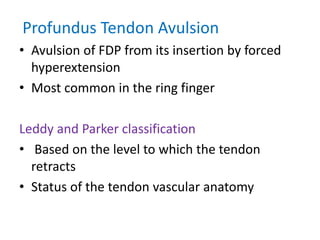 Profundus Tendon Avulsion
• Avulsion of FDP from its insertion by forced
hyperextension
• Most common in the ring finger
Leddy and Parker classification
• Based on the level to which the tendon
retracts
• Status of the tendon vascular anatomy
 