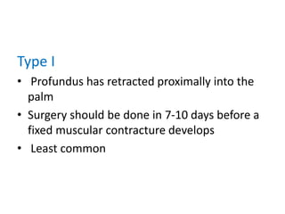 Type I
• Profundus has retracted proximally into the
palm
• Surgery should be done in 7-10 days before a
fixed muscular contracture develops
• Least common
 