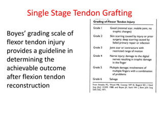 Boyes’ grading scale of
flexor tendon injury
provides a guideline in
determining the
achievable outcome
after flexion tendon
reconstruction
Single Stage Tendon Grafting
 
