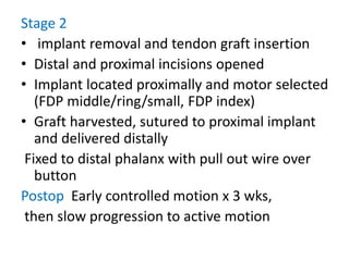 Stage 2
• implant removal and tendon graft insertion
• Distal and proximal incisions opened
• Implant located proximally and motor selected
(FDP middle/ring/small, FDP index)
• Graft harvested, sutured to proximal implant
and delivered distally
Fixed to distal phalanx with pull out wire over
button
Postop Early controlled motion x 3 wks,
then slow progression to active motion
 