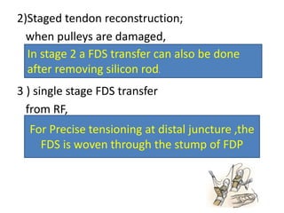 2)Staged tendon reconstruction;
when pulleys are damaged,
3 ) single stage FDS transfer
from RF,
In stage 2 a FDS transfer can also be done
after removing silicon rod.
For Precise tensioning at distal juncture ,the
FDS is woven through the stump of FDP
 