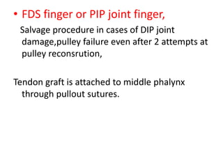 • FDS finger or PIP joint finger,
Salvage procedure in cases of DIP joint
damage,pulley failure even after 2 attempts at
pulley reconsrution,
Tendon graft is attached to middle phalynx
through pullout sutures.
 