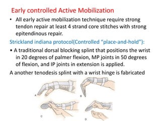 Early controlled Active Mobilization
• All early active mobilization technique require strong
tendon repair at least 4 strand core stitches with strong
epitendinous repair.
Strickland indiana protocol(Controlled “place-and-hold”):
• A traditional dorsal blocking splint that positions the wrist
in 20 degrees of palmer flexion, MP joints in 50 degrees
of flexion, and IP joints in extension is applied.
A another tenodesis splint with a wrist hinge is fabricated
 