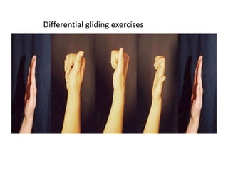 Differential gliding exercises
 