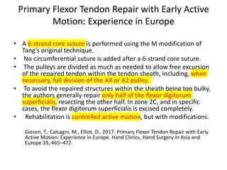 Primary Flexor Tendon Repair with Early Active
Motion: Experience in Europe
• A 6-strand core suture is performed using the M modification of
Tang’s original technique.
• No circumferential suture is added after a 6-strand core suture.
• The pulleys are divided as much as needed to allow free excursion
of the repaired tendon within the tendon sheath, including, when
necessary, full division of the A4 or A2 pulley.
• To avoid the repaired structures within the sheath being too bulky,
the authors generally repair only half of the flexor digitorum
superficialis, resecting the other half. In zone 2C, and in specific
cases, the flexor digitorum superficialis is excised completely.
• Rehabilitation is controlled active motion, but with modifications.
Giesen, T., Calcagni, M., Elliot, D., 2017. Primary Flexor Tendon Repair with Early
Active Motion: Experience in Europe. Hand Clinics, Hand Surgery in Asia and
Europe 33, 465–472
 