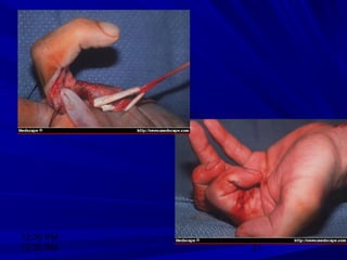 12:30 PM
12:30 PM 21
 