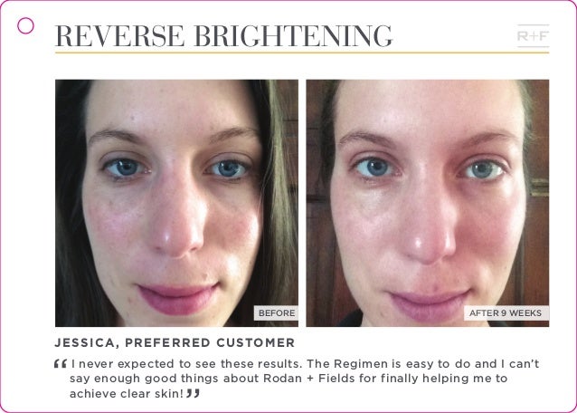 reverse brightening rodan and fields