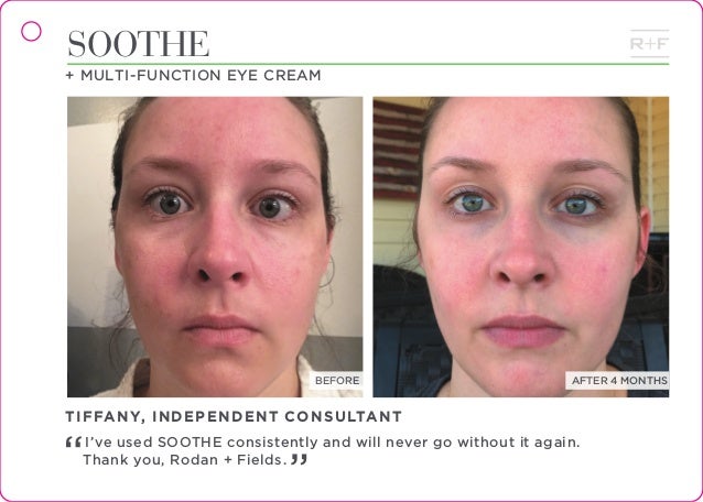 rodan and fields eye cream results