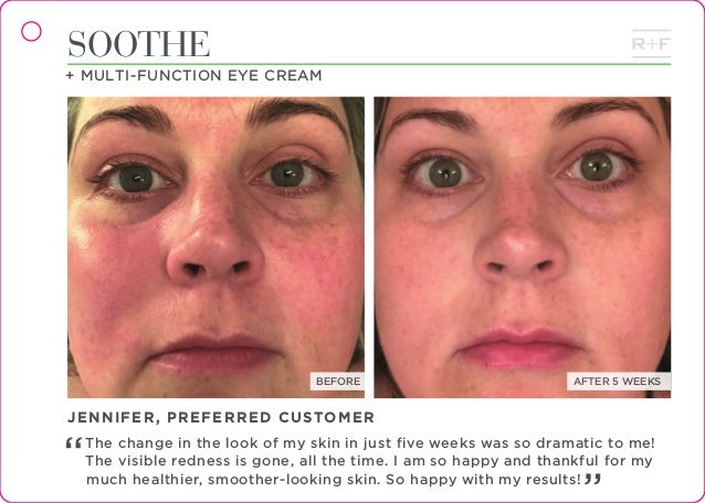 rodan and fields eye cream results