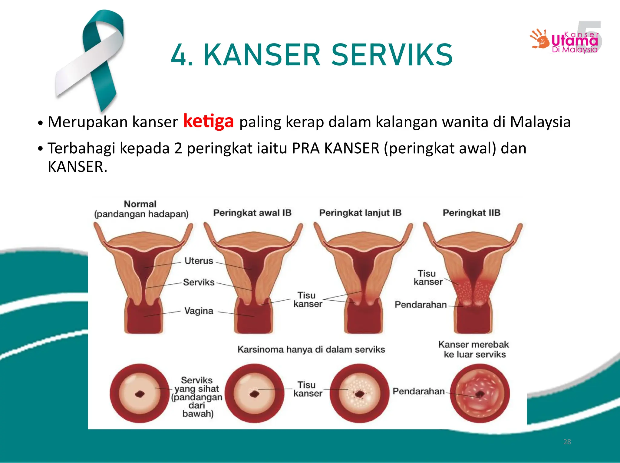 Flip_Chart_Kanser_Utama_di_Malaysia.pdff