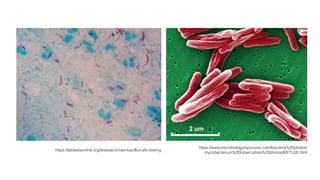 https://www.microbiologyinpictures.com/bacteria%20photos/
mycobacterium%20tuberculosis%20photos/MYTU20.html
https://labtestsonline.org/tests/acid-fast-bacillus-afb-testing
 