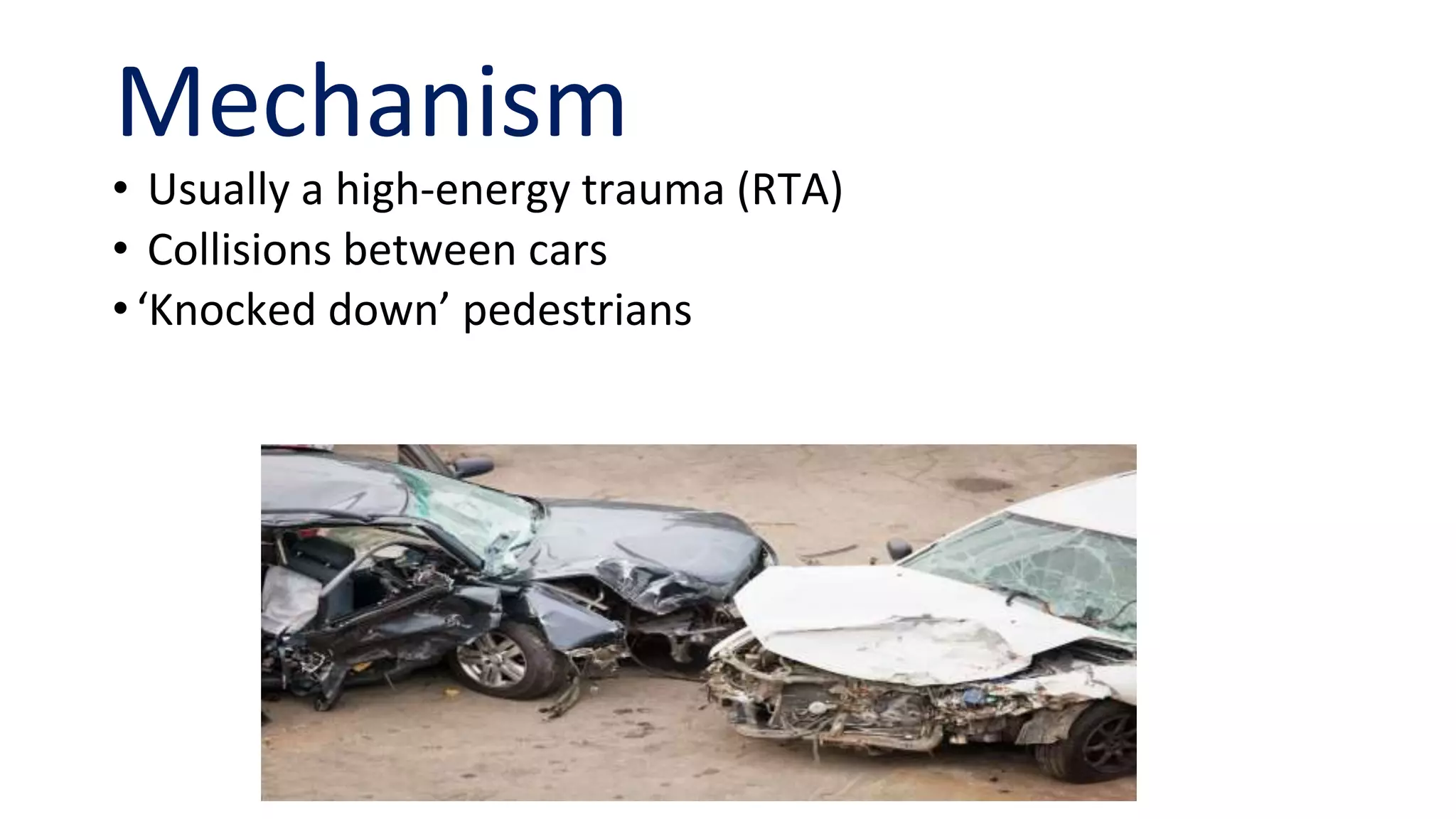 Floating knee injuries | PPTX