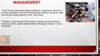 MANAGEMENT
-These fractures are almost always produced by high-energy trauma and
are often associated with other life-threatening conditions, as well as other
fractures and varying degrees of soft- tissue lesion.
-Therefore, advanced trauma life support protocols should be followed
rigorously and the patient stabilised before orthopaedic treatment can be
considered.
 