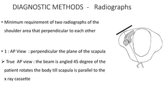 DIAGNOSTIC METHODS - Radiographs
• Minimum requirement of two radiographs of the
shoulder area that perpendicular to each other
• 1 : AP View : perpendicular the plane of the scapula
 True AP view : the beam is angled 45 degree of the
patient rotates the body till scapula is parallel to the
x ray cassette
 