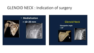 GLENOID NECK : Indication of surgery
 