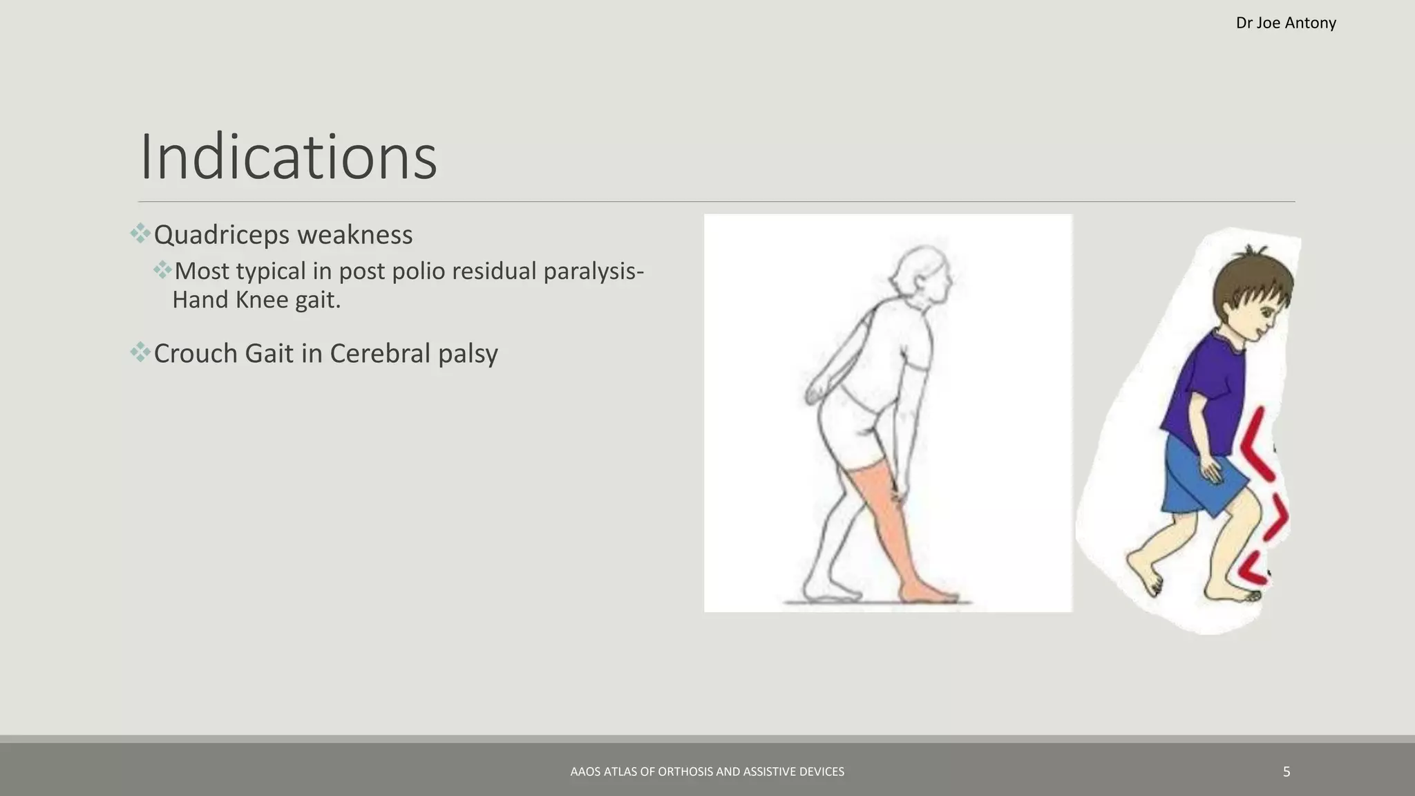 Floor reaction Ankle foot orthosis or Gravity reaction ankle foot ...