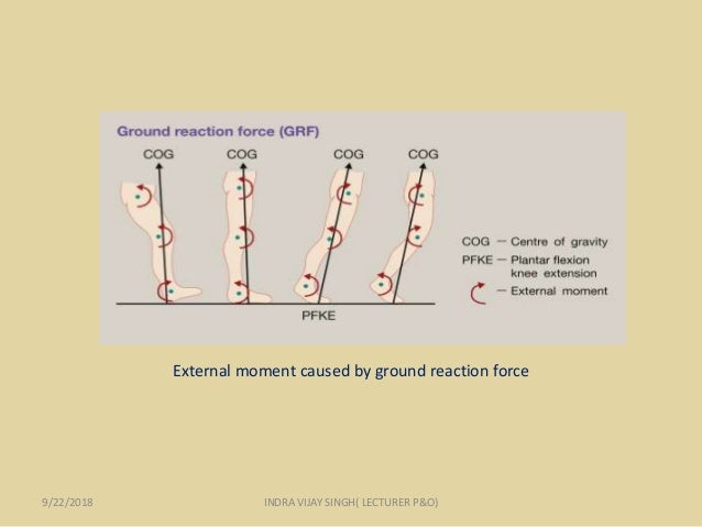 Floor Reaction Orthosis