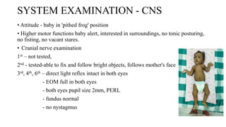 approach to exam of floppy infant-1 (2).pptx