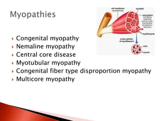  Congenital myopathy
 Nemaline myopathy
 Central core disease
 Myotubular myopathy
 Congenital fiber type disproportion myopathy
 Multicore myopathy
 