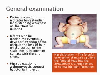 Hip dislocation - The forceful
contraction of muscles pulling
the femoral head into the
acetabulum is a requirement
of normal hip joint formation.
 Pectus excavatum
indicates long standing
long-standing weakness
of the chest wall
muscles
 Infants who lie
motionless eventually
develop flattening of the
occiput and loss of hair
on the portion of the
scalp that is in constant
contact with the crib
sheet.
 Hip subluxation or
arthrogryposis suggest
hypotonia in utero .
 